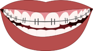 orthodontics, smile, teeth-3109763.jpg